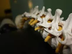 Az arthritis psoriatica helye a spondylarthritisek körében