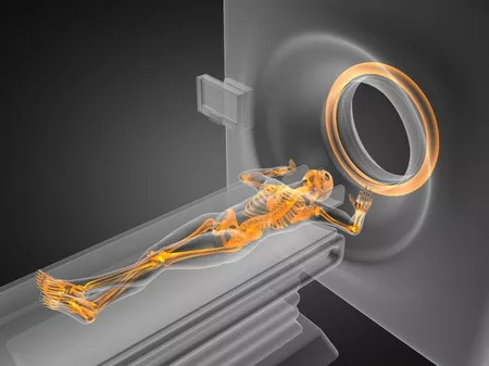 Az EMA korlátozza az MRI-kontrasztanyagok alkalmazását