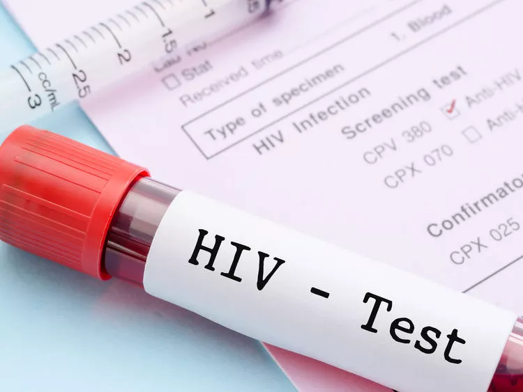 Hiányzik az államilag támogatott HIV-szűrés