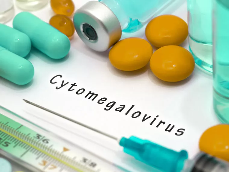 Gyorsíthatja a cytomegalovírus a cisztás fibrózis progresszióját