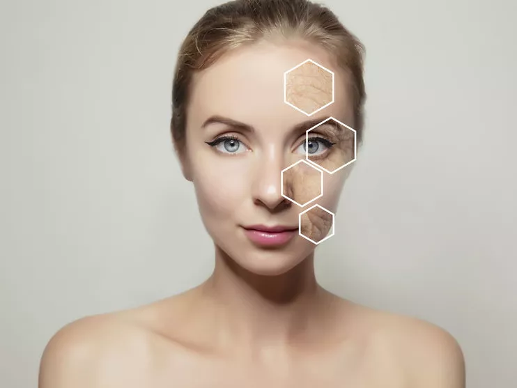 Az acne és a rosacea korszerű kezelése