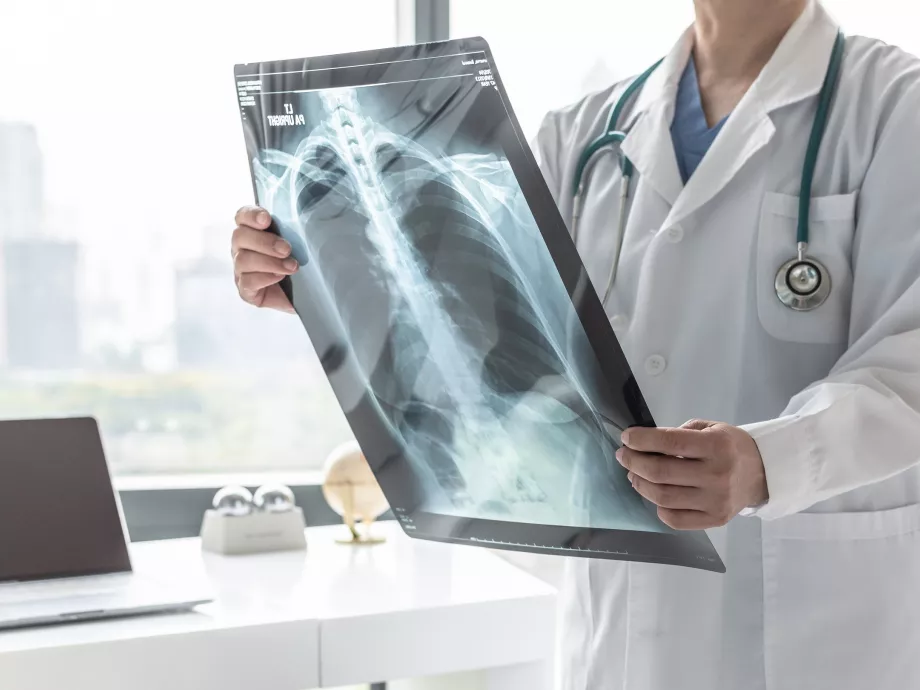 COPD Világnap: 500 ezer krónikus tüdőbeteg élhet Magyarországon