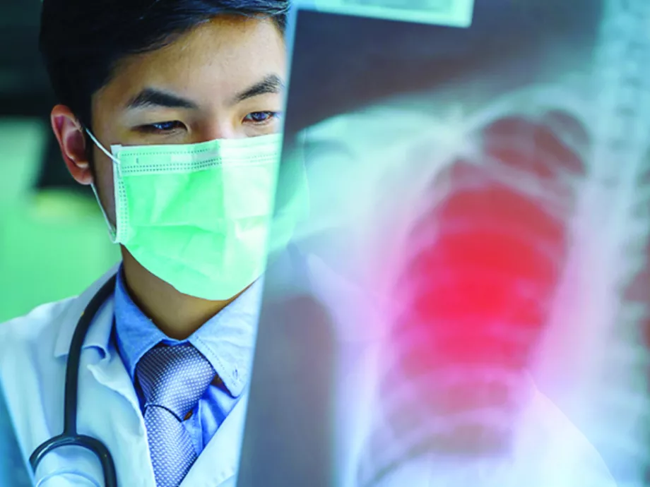 Fókuszban a pneumonitis: az immunterápiák mellett várható mellékhatások
